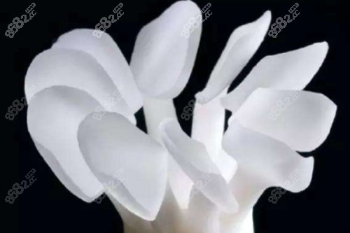 牙齒貼片模型圖 牙齒貼片模型圖