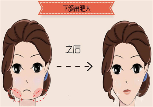 國(guó)內(nèi)皮貼骨三件套哪家醫(yī)院好？武漢中翰北京圣嘉新 10 院對(duì)比，2026 選對(duì)地區(qū)避坑不僵硬
