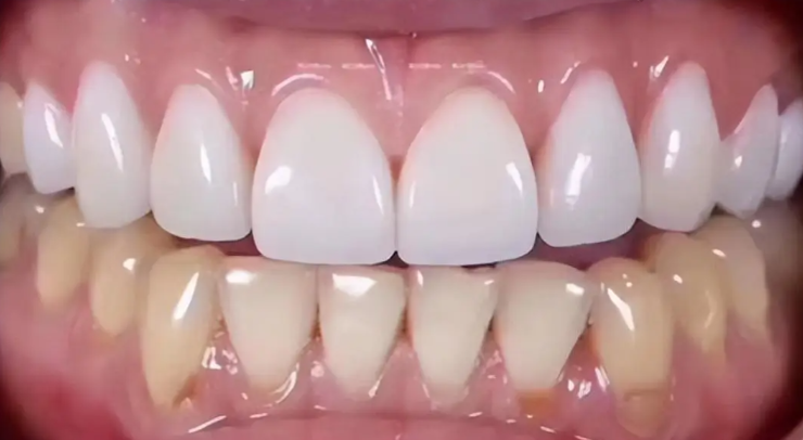 四、寶雞微笑口腔是正規(guī)的嗎，從大家的反饋來看