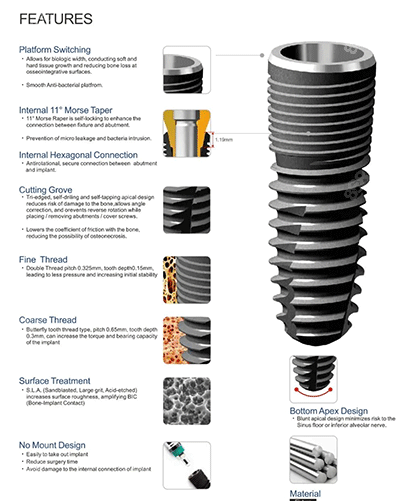 安聯(lián)種植牙植體細節(jié)圖片