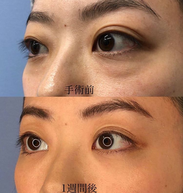 選擇北京歐洲之星醫(yī)院的避坑攻略，你知道嗎？