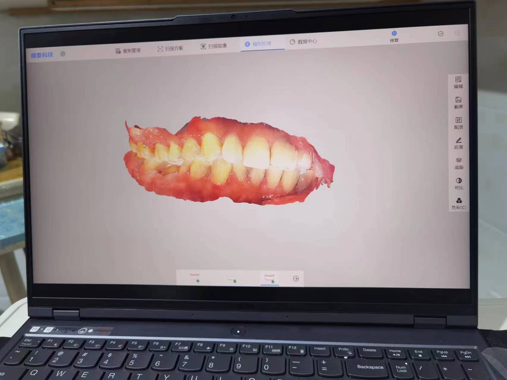 潮州極至口腔的特色項目，讓你看牙不糾結(jié)