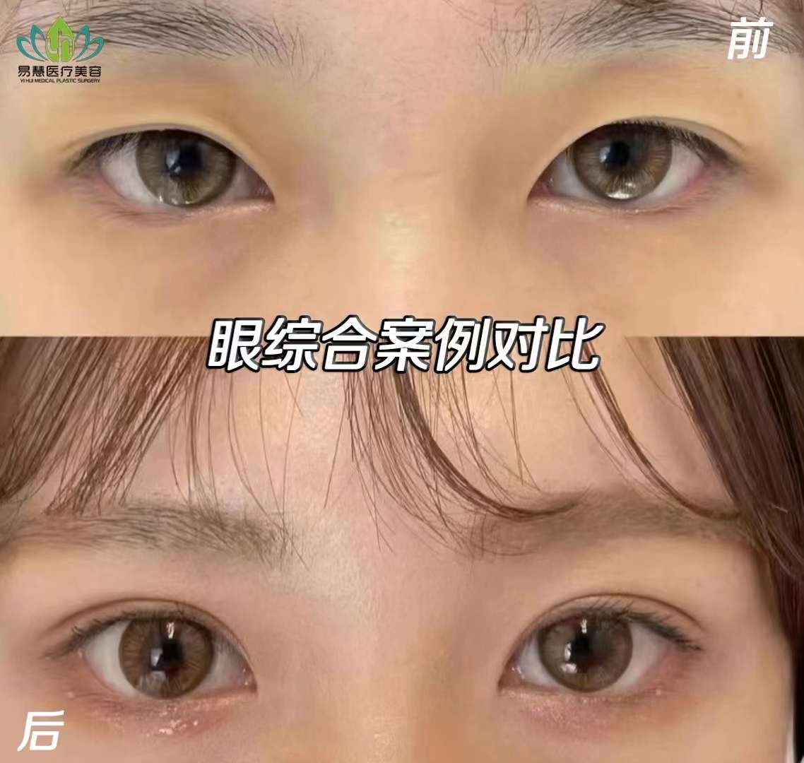 預(yù)約與注意事項(xiàng)