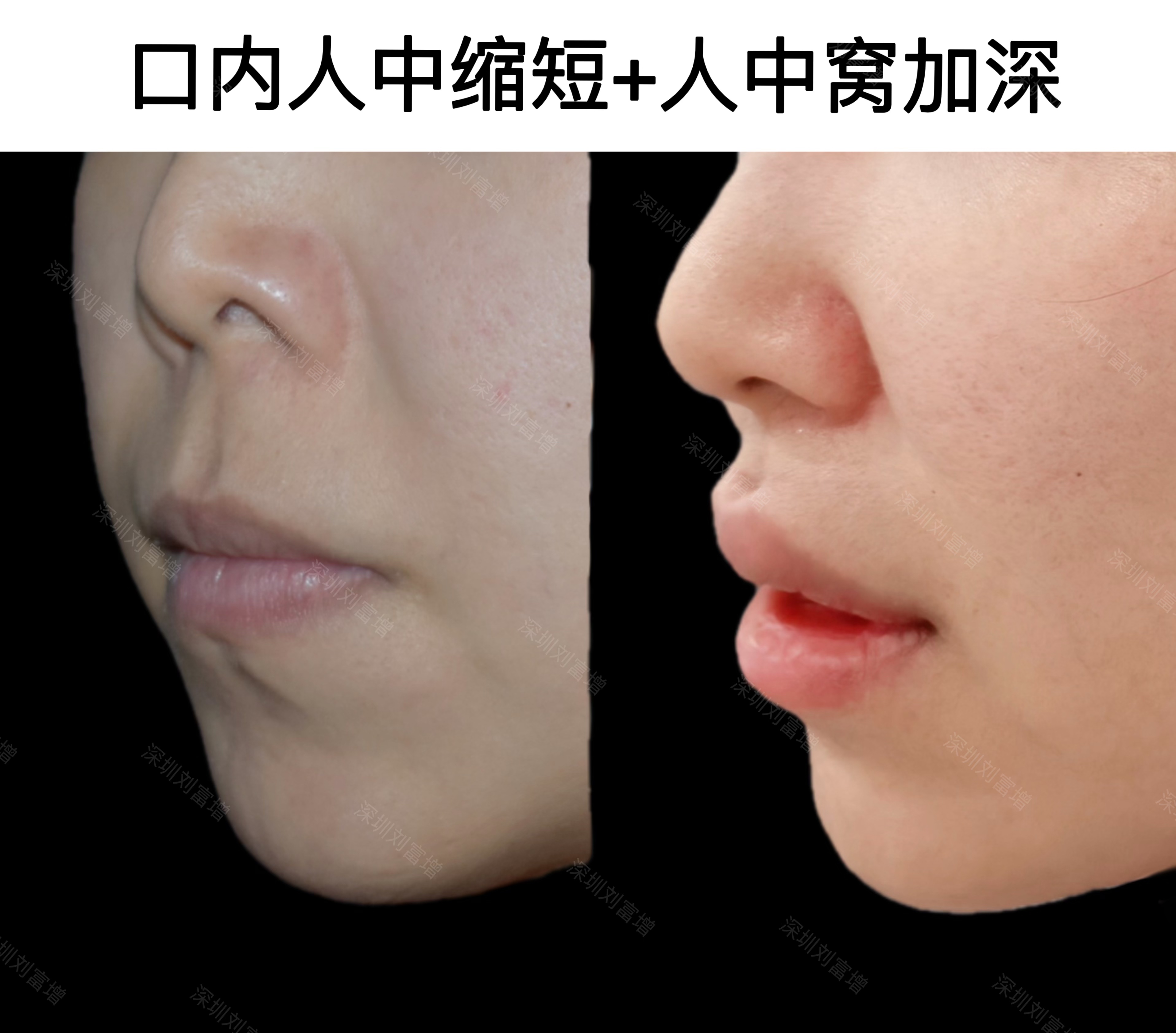 核心技術優(yōu)勢