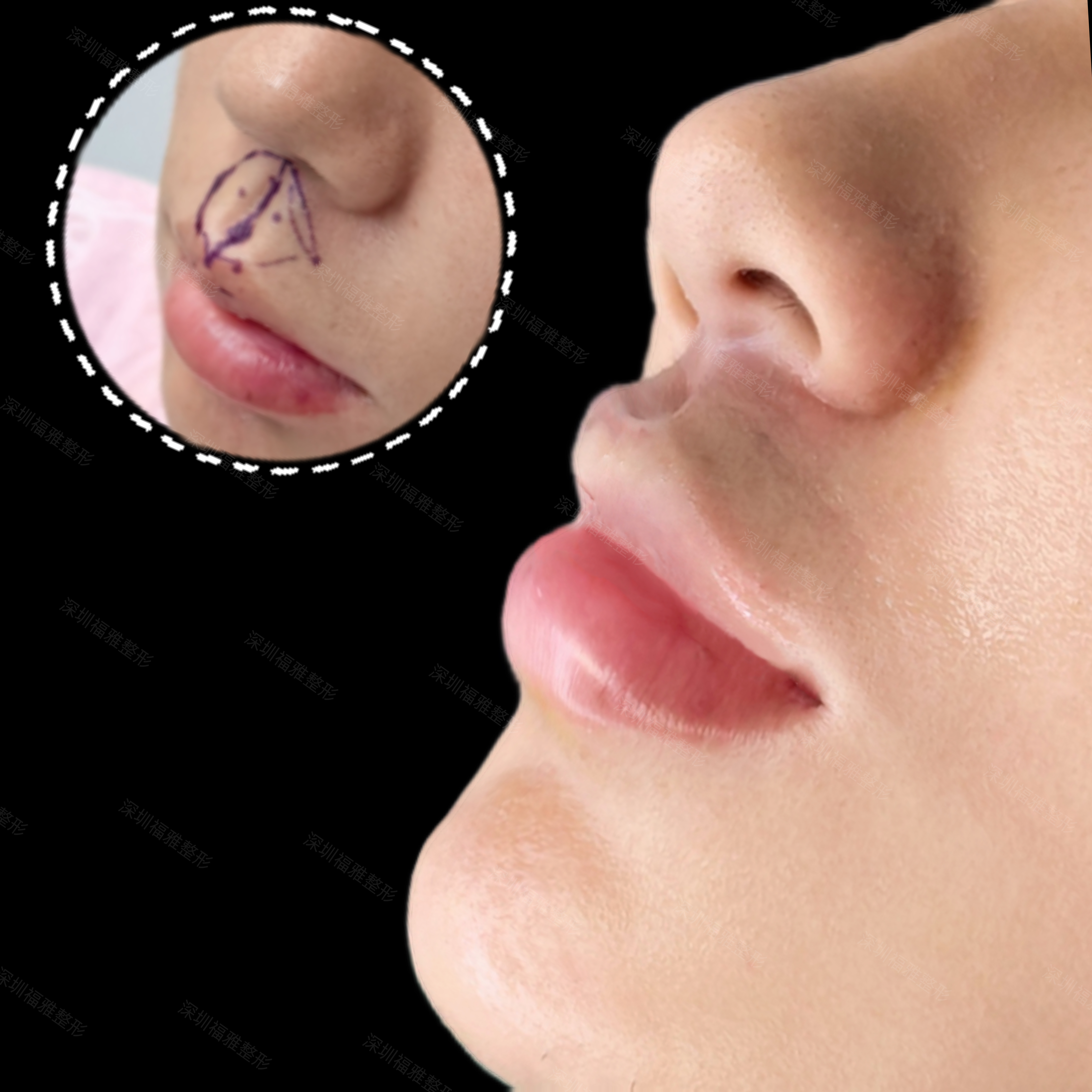 術后護理與服務保護