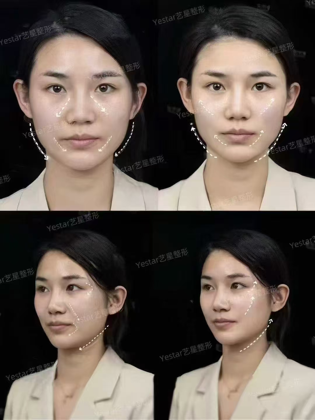 醫(yī)生團(tuán)隊(duì)：南方醫(yī)院專精力量護(hù)航