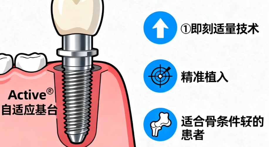 进口种植体品牌在排行榜中的优势