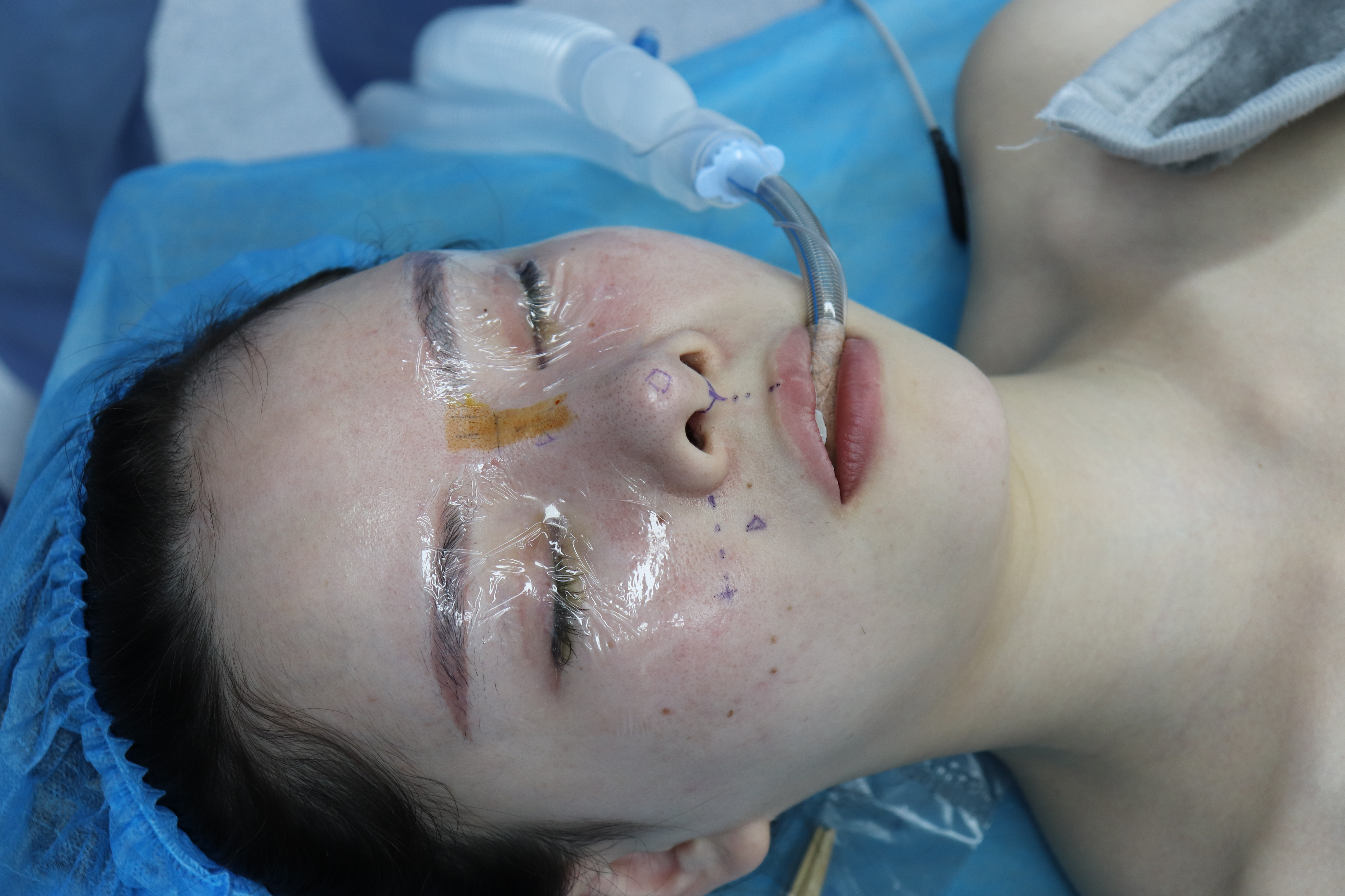 價(jià)格體系：宜興華星醫(yī)療美容門診的誠信擔(dān)當(dāng)