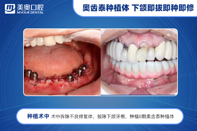 南京韓辰孟幻醫(yī)生技術咋樣？——擅長項目優(yōu)勢