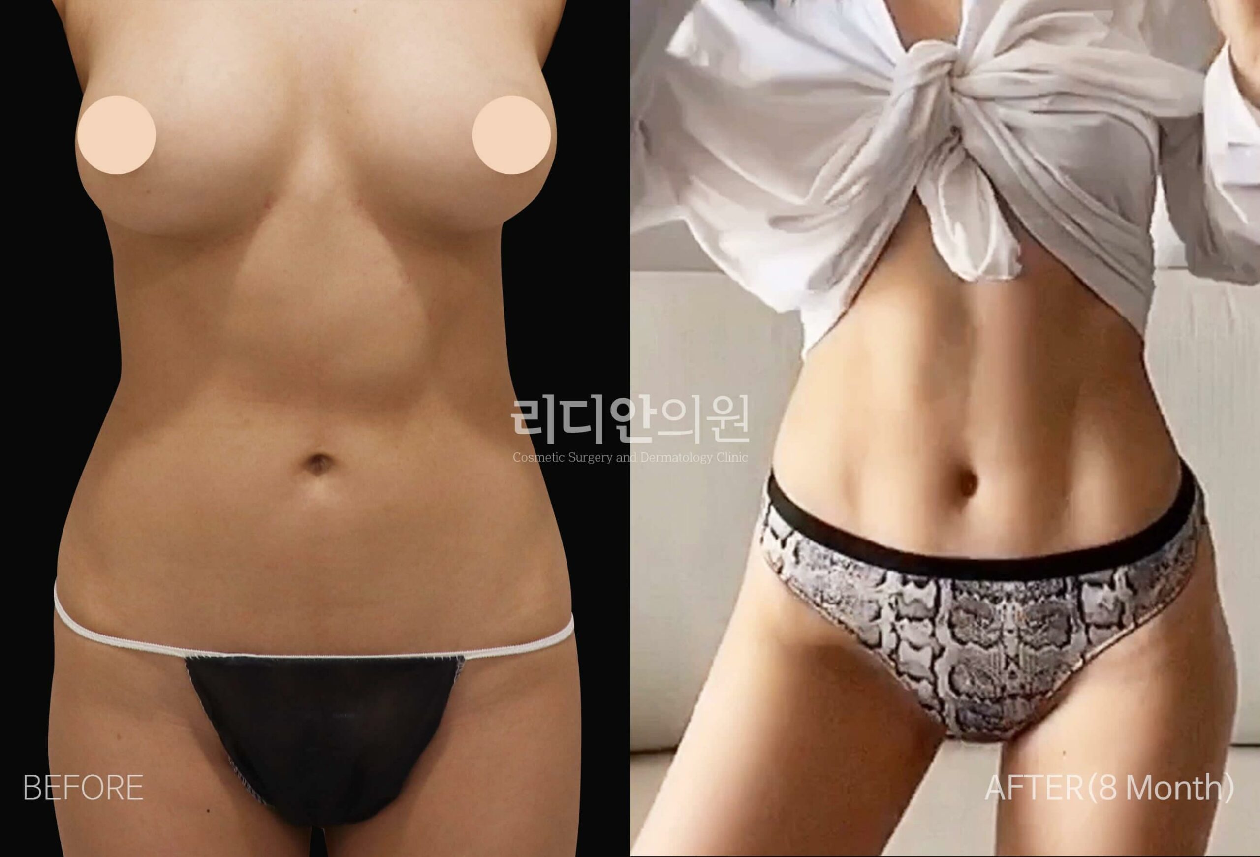 術(shù)后修復(fù)