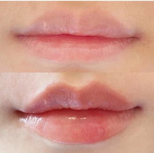 預(yù)約指南與理性行動步驟