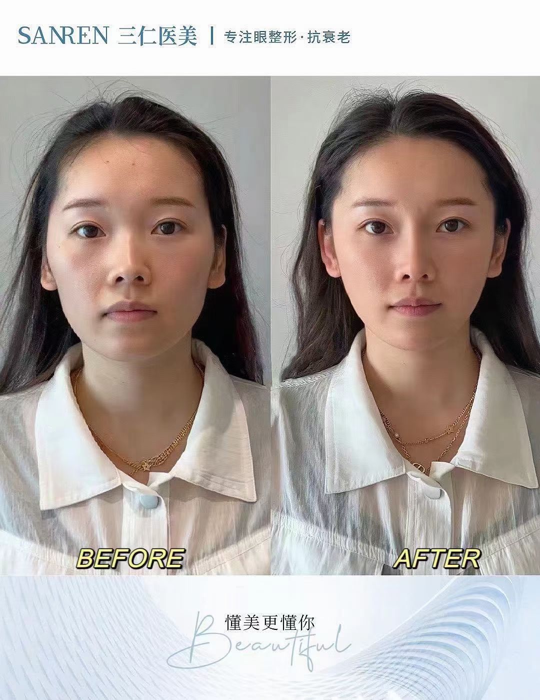 五、在三等甲醫(yī)院手術的風險與優(yōu)勢