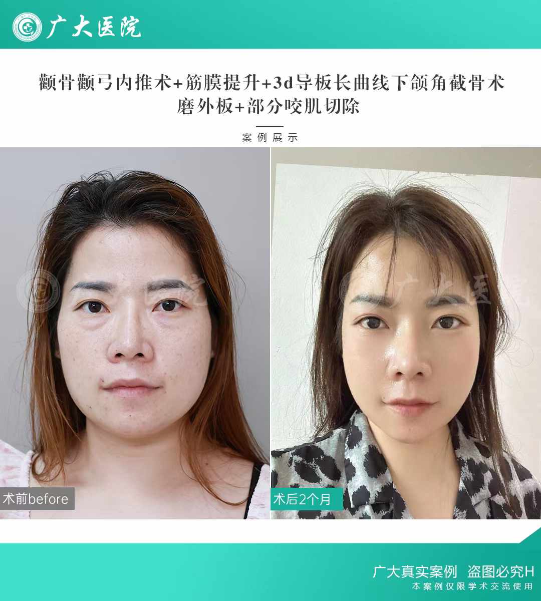 七、如何預約夏志冉醫(yī)生？