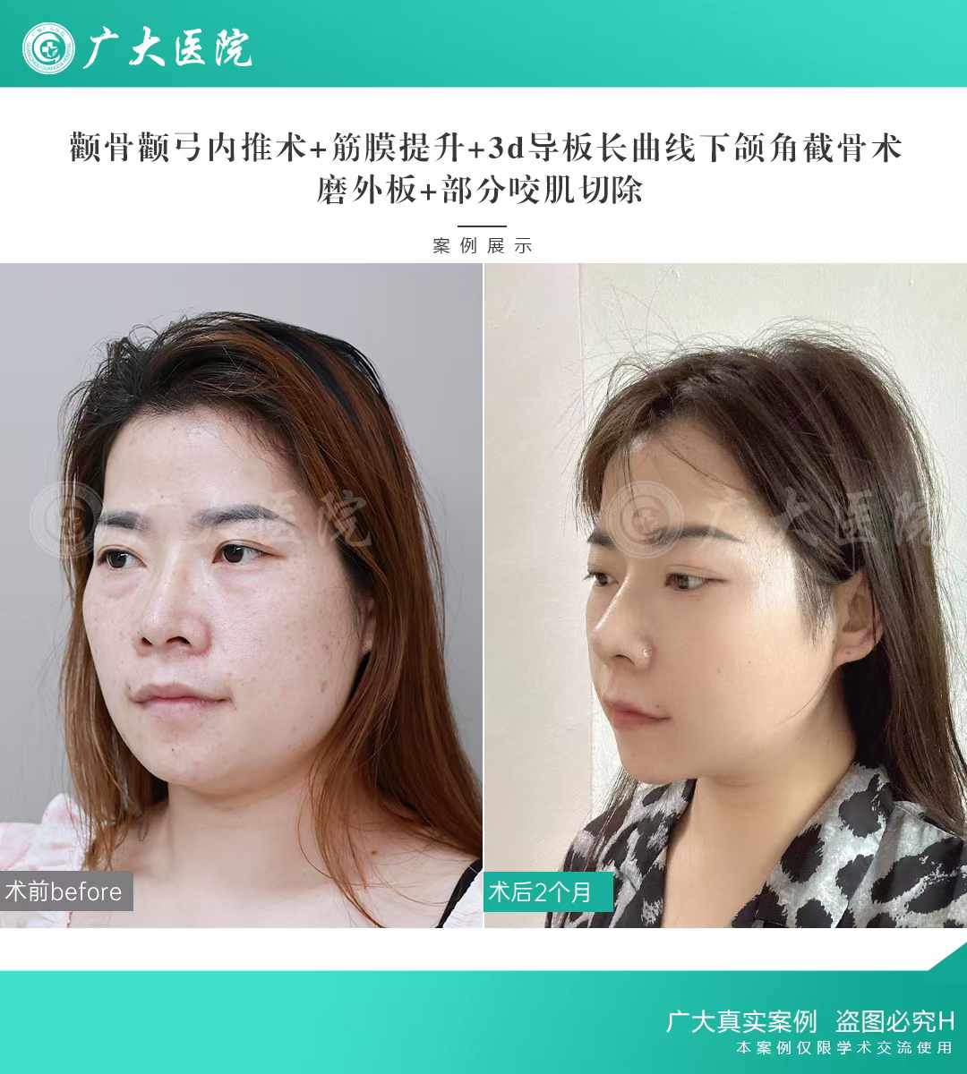 八、選對醫(yī)生，面部提升才值得