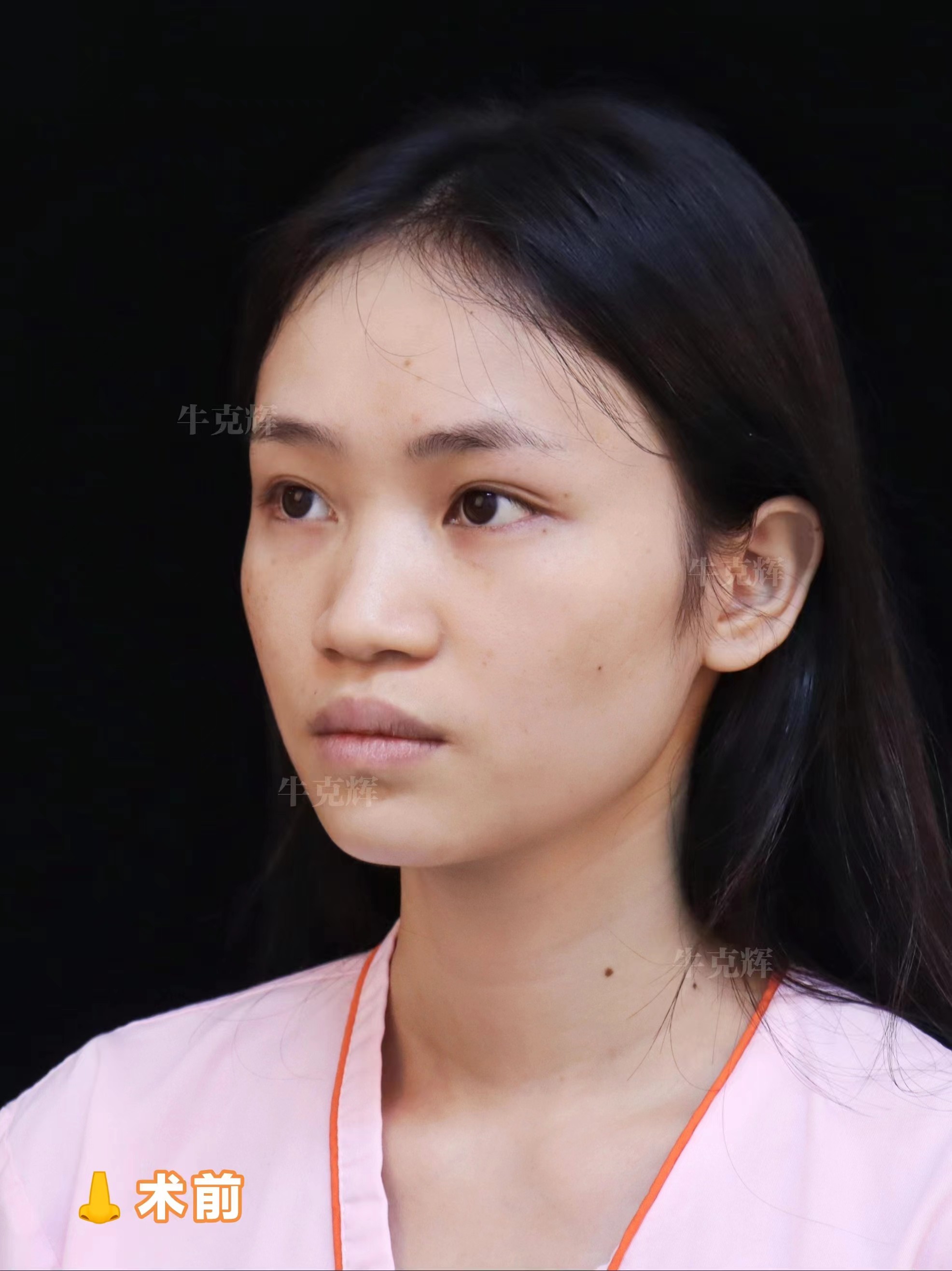 二、巫文云醫(yī)生技術(shù)優(yōu)勢：多方面展現(xiàn)高超技藝