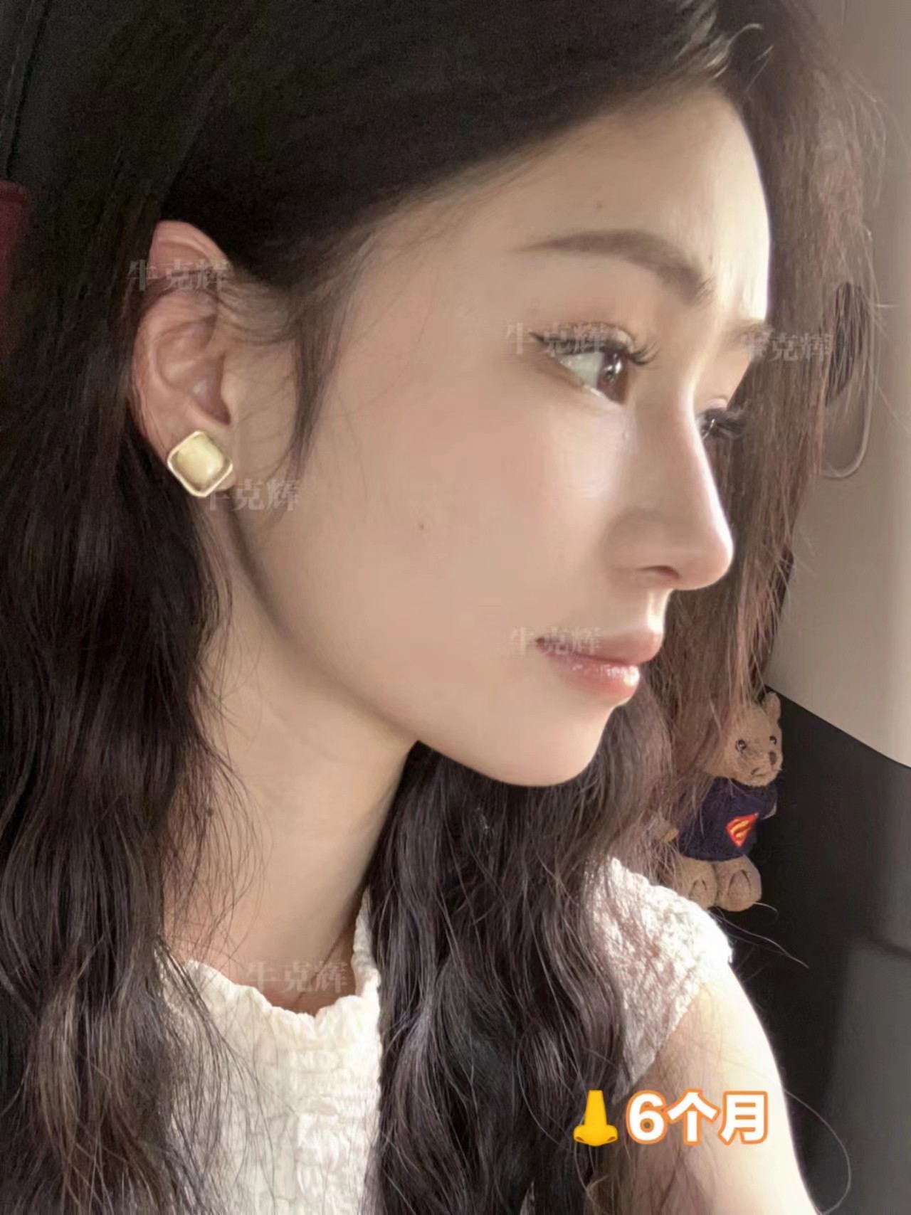 四、為什么選擇巫文云醫(yī)生：五大硬核理由m.sorencai.cn