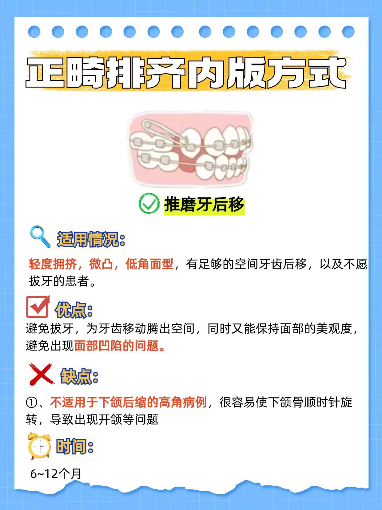 五、正雅GS版與經(jīng)典版的日常護(hù)理要點(diǎn)