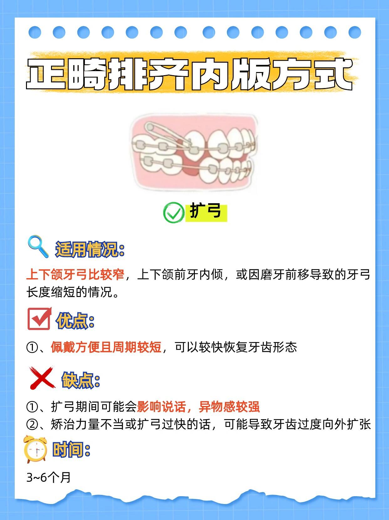 四、正雅GS版與經(jīng)典版的價(jià)格影響因素及談判技巧