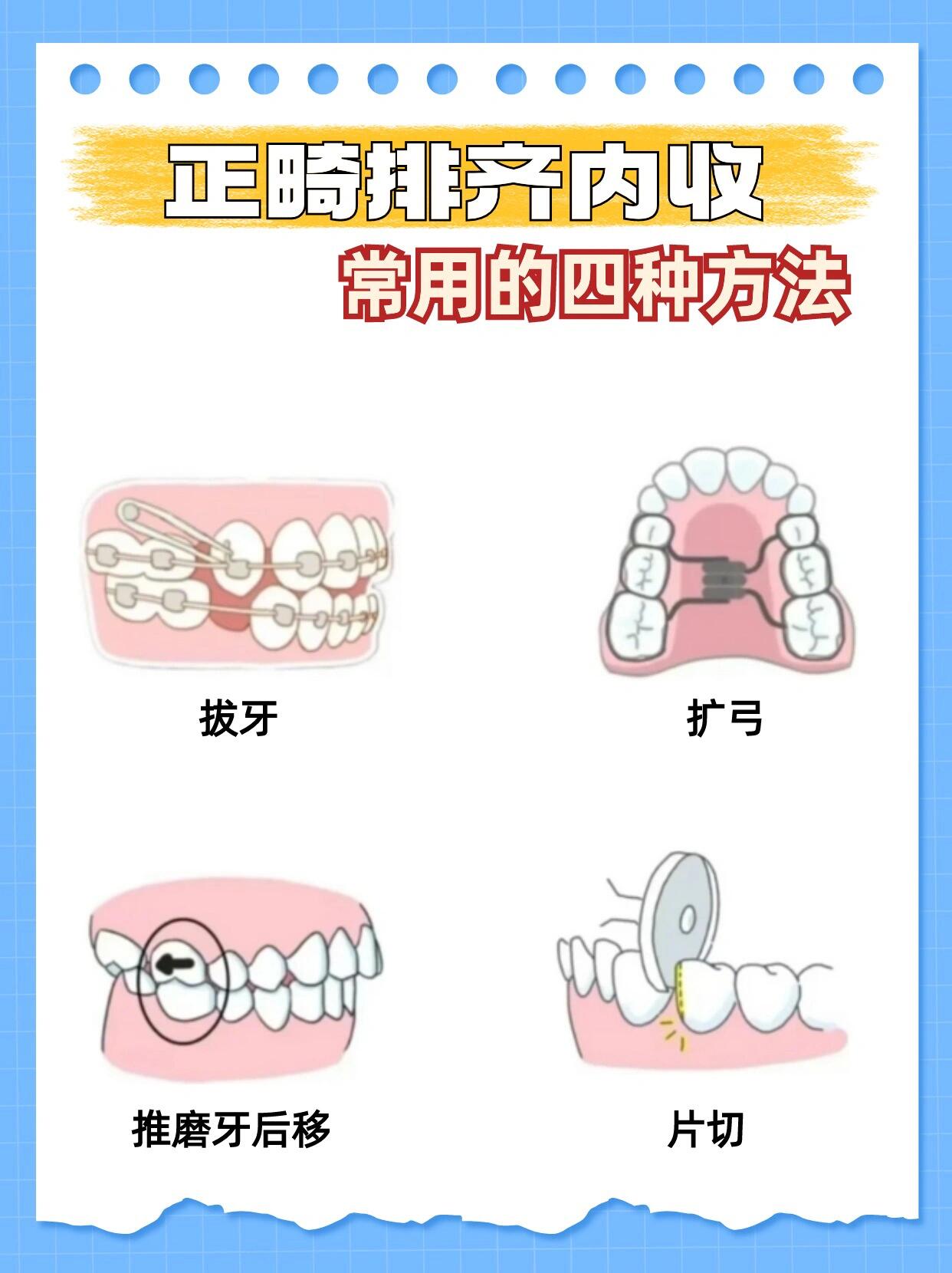二、正雅GS版與經(jīng)典版在私立醫(yī)院的選擇要點(diǎn)m.sorencai.cn