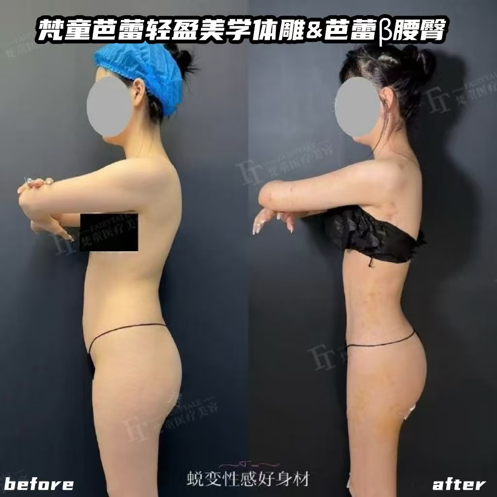 三、價(jià)格邏輯：孫澤芳自體脂肪項(xiàng)目，為什么是這個(gè)價(jià)？