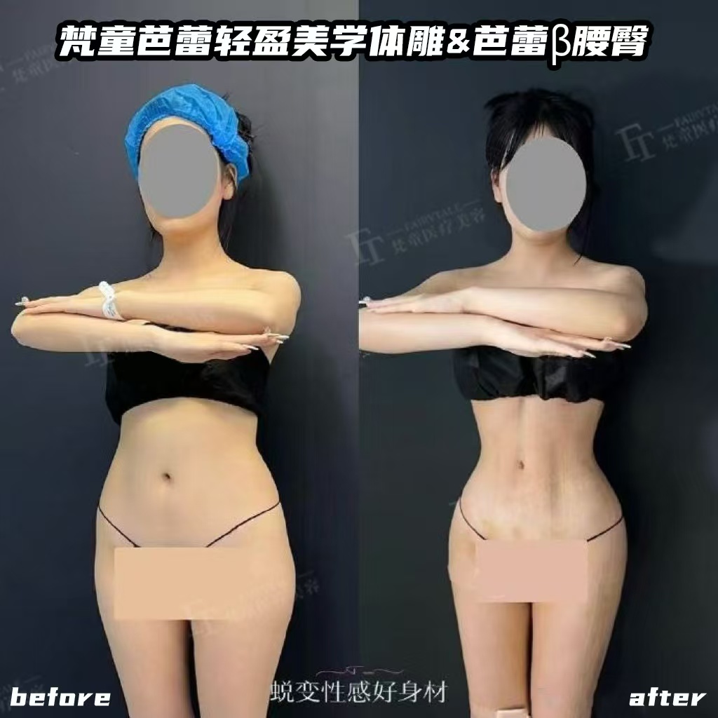 五、決策參考：在三等甲醫(yī)院做脂肪移植，風(fēng)險(xiǎn)和優(yōu)勢(shì)分別是什么？