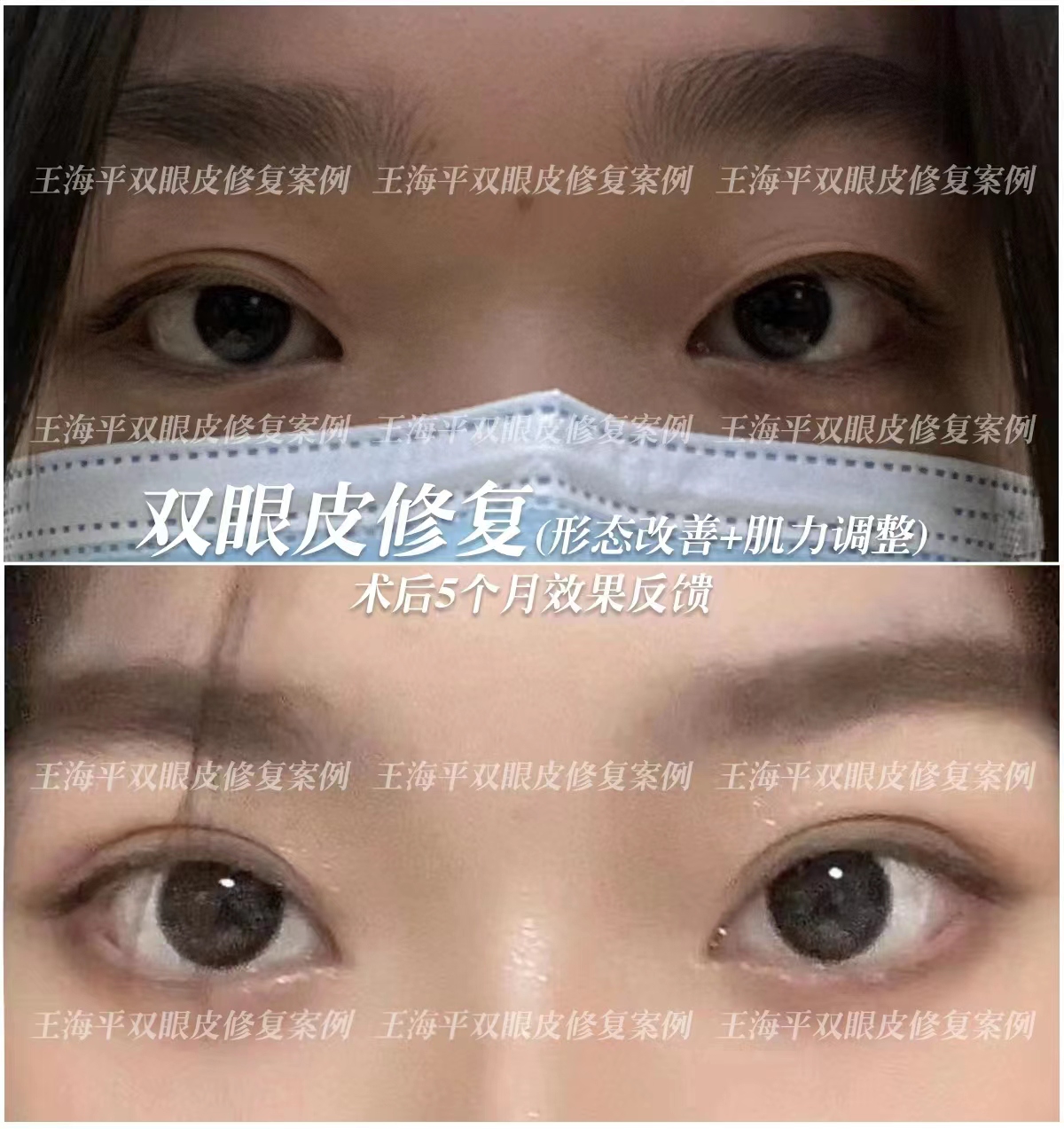 六、實用預(yù)約攻略與面診準(zhǔn)備