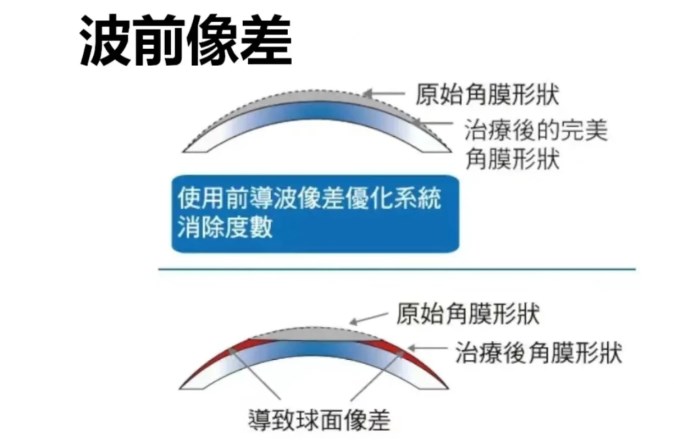 二、長沙市第一醫(yī)院眼科的精良設(shè)備助力價(jià)格合理