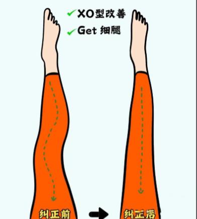 想要超模漫畫腿？上海做直腿術(shù)好的醫(yī)生推薦：盧九寧/魏潔/李靜等10個醫(yī)生審美在線