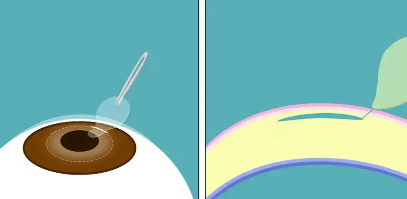 五、溫州明樂眼科醫(yī)院的價(jià)格透明度和性價(jià)比如何？