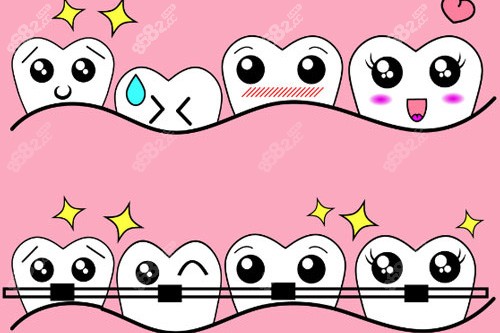 牙齒矯正反彈卡通圖