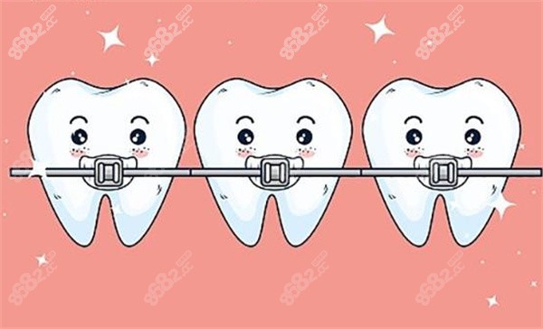 牙齒矯正卡通示意圖