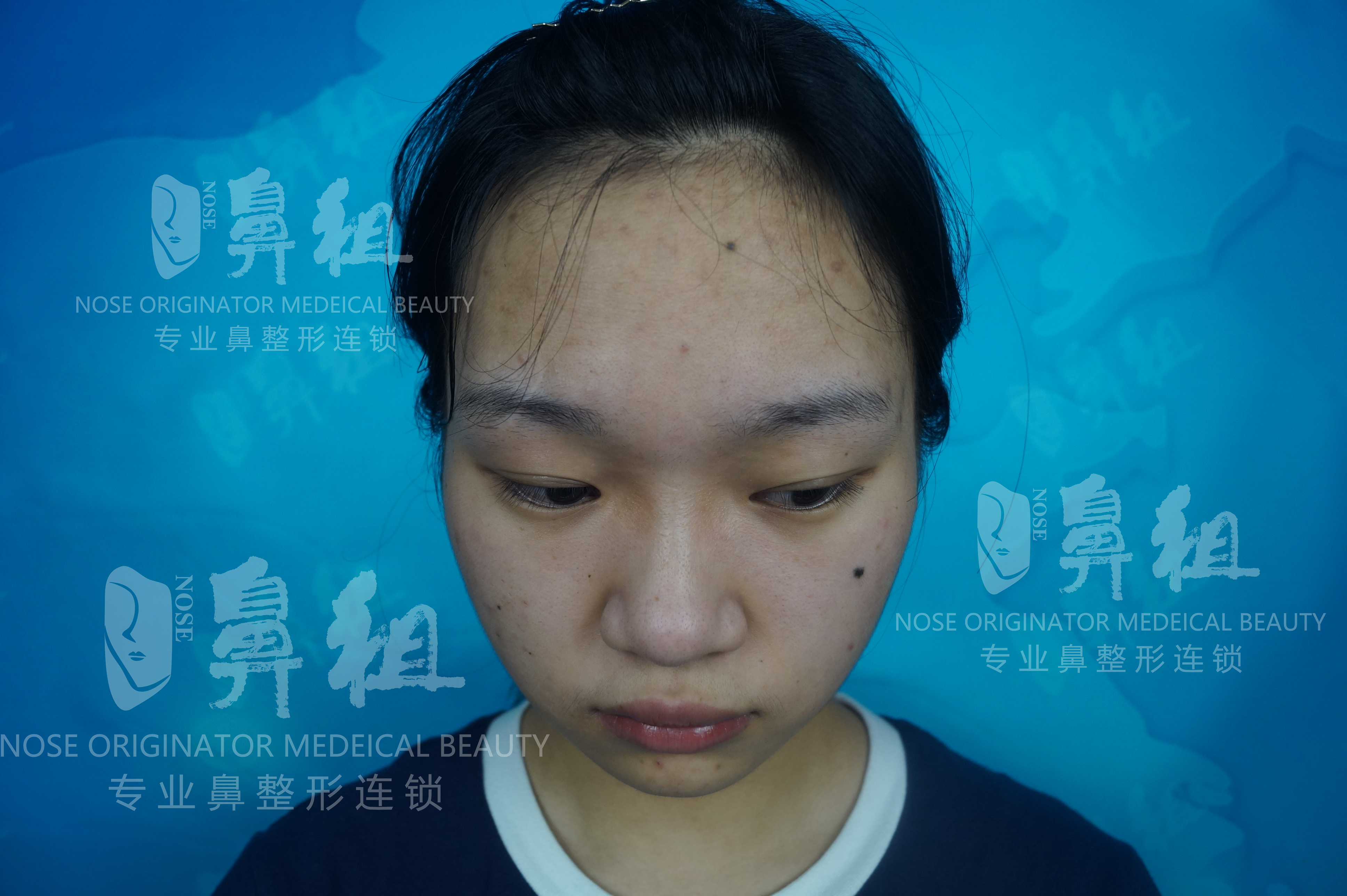 南京韓辰周穎華的注射優(yōu)勢