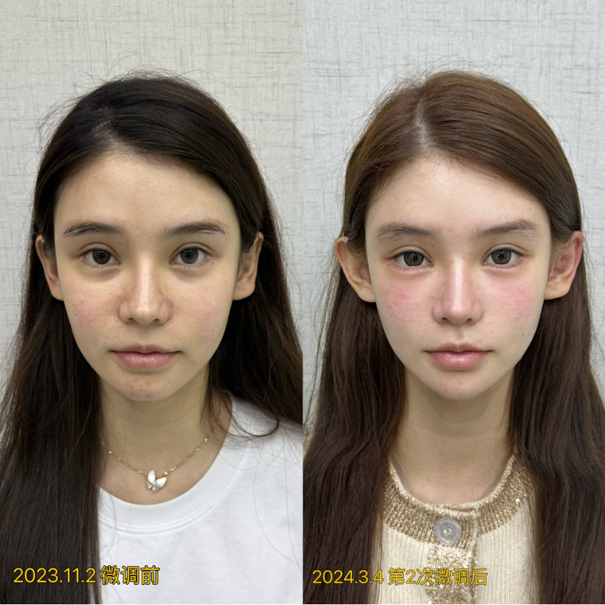 五、上海幼態(tài)臉技術的重要性及市場需求