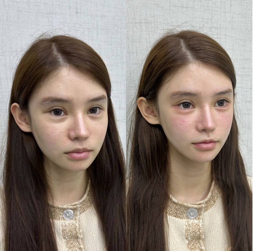 六、選擇上海幼態(tài)臉醫(yī)生的注意事項