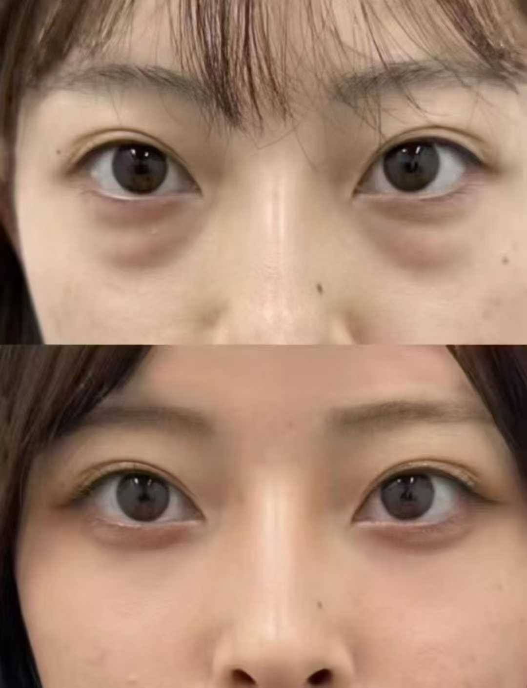 北京大學第三醫(yī)院 - 成形外科