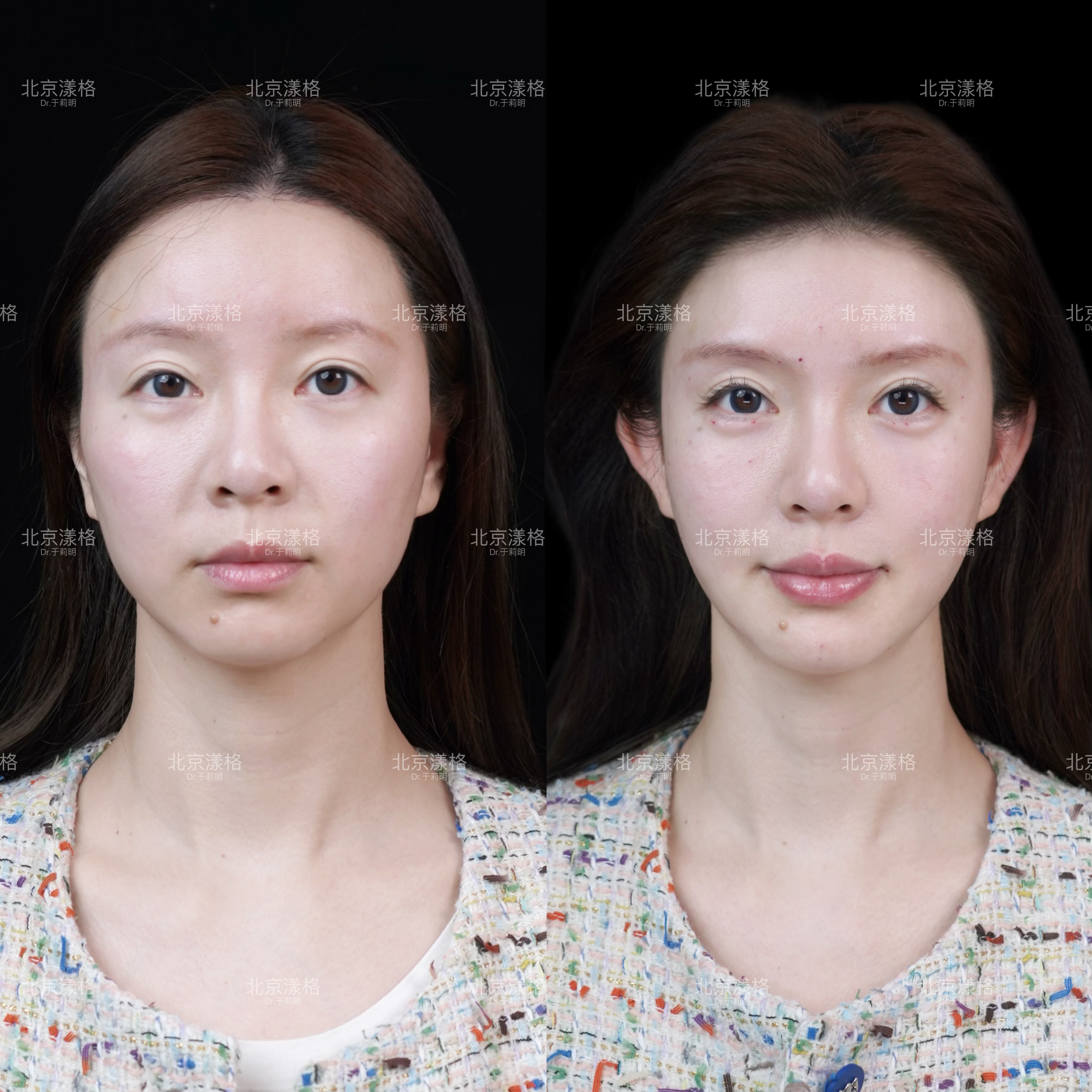 三、上海華美聶婕醫(yī)生