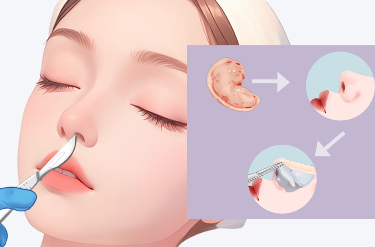 如何預(yù)約吳焱秋醫(yī)生？掌握正確流程更效率高