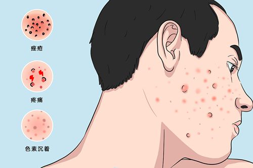 六、杭州浮想國熱瑪吉價格表值不值得做