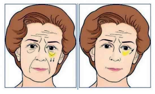 北京中 醫(yī) 藥大學東直門醫(yī)院 - 醫(yī)療美容科m.sorencai.cn