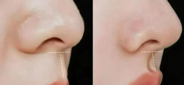 譚拯人中縮短價(jià)格參考與實(shí)例分享