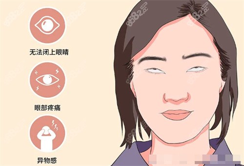 需要做眼修復(fù)的情況