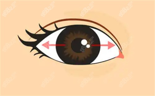 眼球震顫的表現(xiàn)圖解 眼球震顫的表現(xiàn)圖解