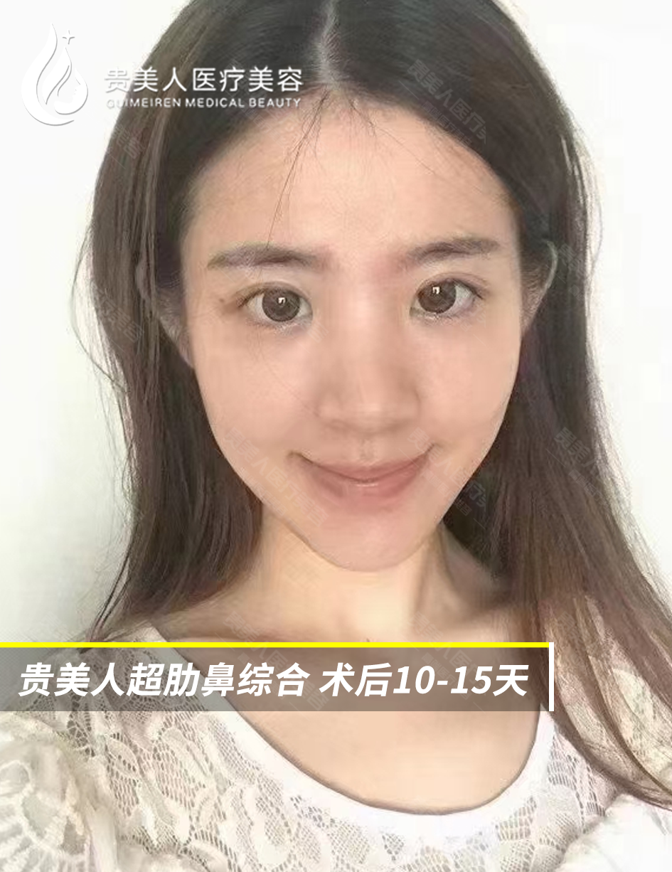 國內(nèi)十大拉皮手術(shù)醫(yī)院醫(yī)生排名揭曉！王志軍、穆寶安等專家實力領銜抗衰前沿