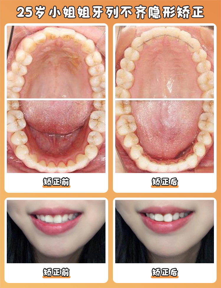 廣州廣大口腔醫(yī)院：矯正技術(shù)的先鋒