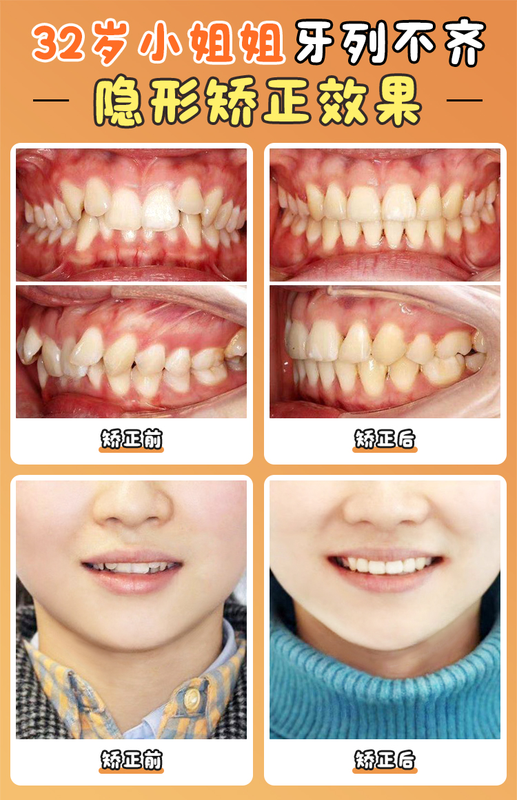 廣州曙光口腔：美學(xué)矯正的引領(lǐng)者