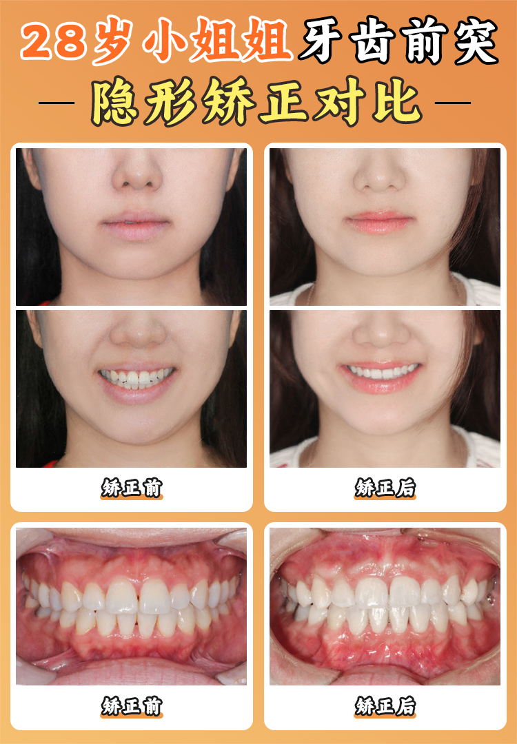 廣州德倫口腔：貼心服務(wù)的矯正骨干醫(yī)生