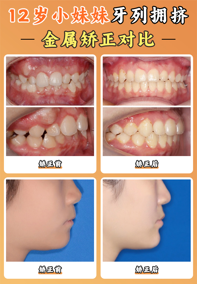 廣州穗華口腔醫(yī)院：專精矯正的典范m.sorencai.cn