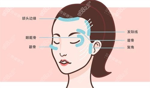 面部提升區(qū)域