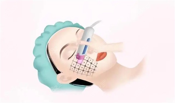 熱瑪吉599元起，面部抗衰價(jià)格真香