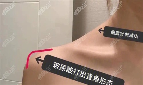 直角肩塑造要點(diǎn)